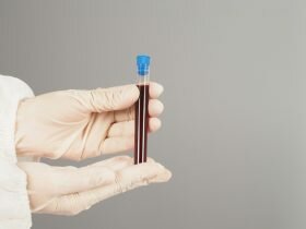 lista de alimentos prohibidos para triglicéridos altos