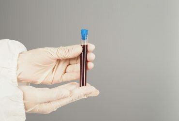 lista de alimentos prohibidos para triglicéridos altos